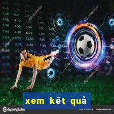 xem kết quả xổ số sóc trăng