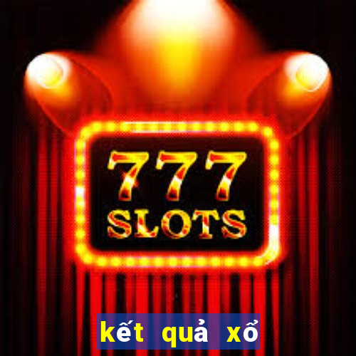 kết quả xổ số 30 ngày net