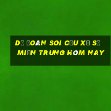 dự đoán soi cầu xổ số miền trung hôm nay