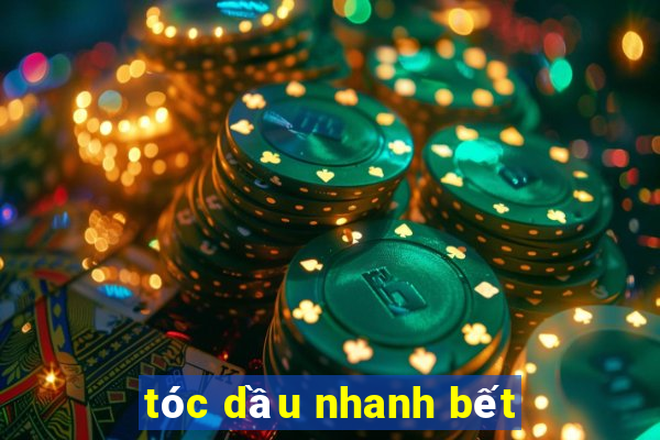 tóc dầu nhanh bết